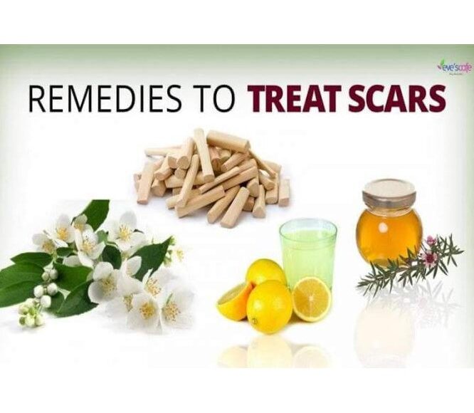 Home Remedies for Scars | Acne Scar Treatment