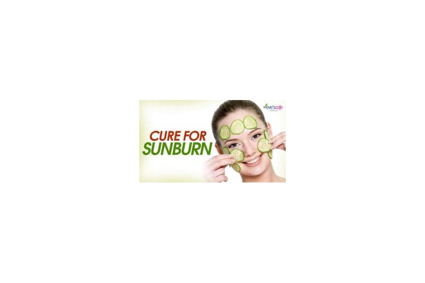 Evescafe | Quick sunburn relief - Sunburn treatment and remedies