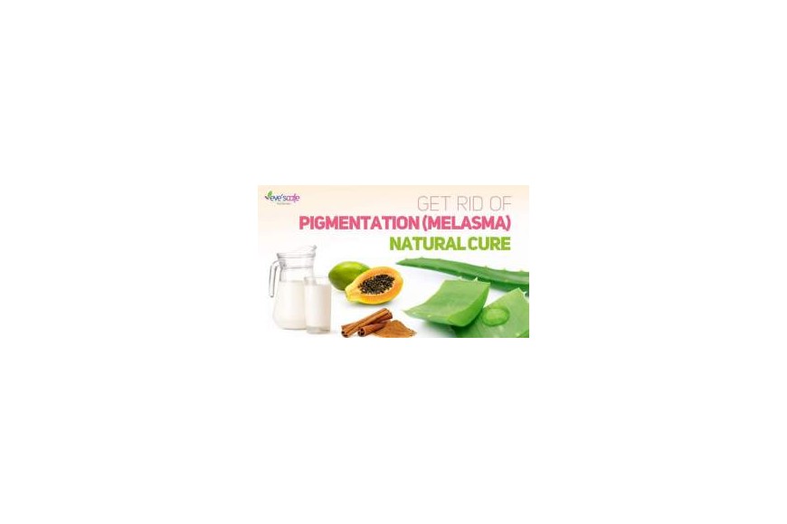 Home Remedies for Pigmentation | Melasma Treatment @ Home
