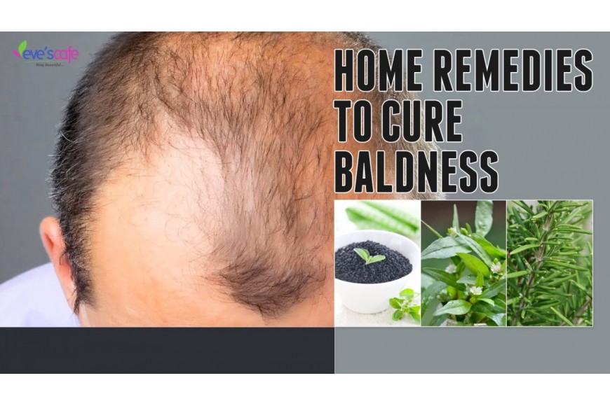 Evescafe | How to treat baldness or regrow hair on bald spot | HOME REMEDY
