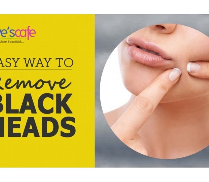 DIY – HOME REMEDIES FOR BLACKHEADS | BLACKHEAD REMOVAL