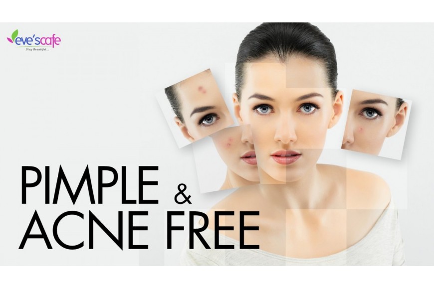 Home Remedies for Acne, Pimple and Cystic Acne