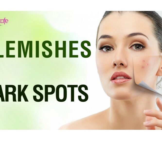 Home Remedies for Blemishes and Dark Spots – Normal Skin