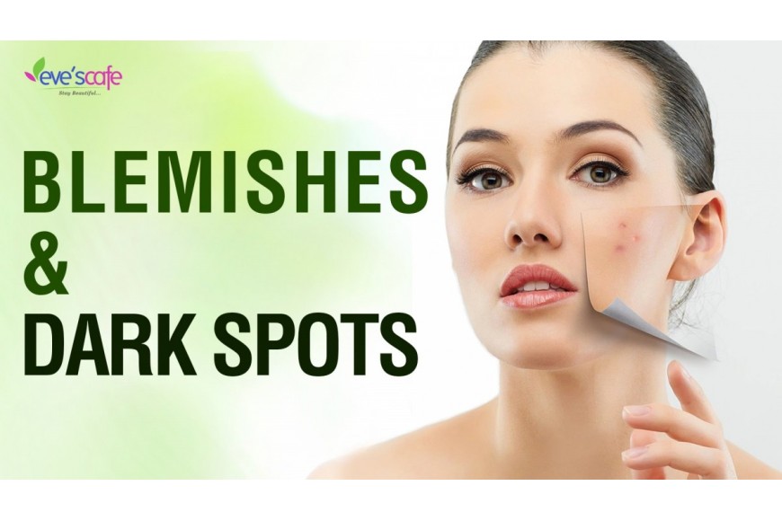 Home Remedies for Blemishes and Dark Spots – Normal Skin