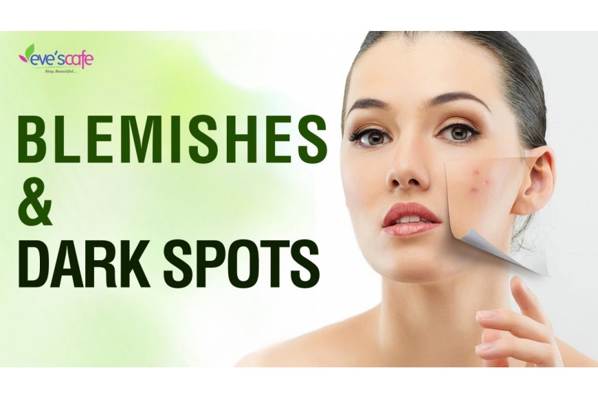 Evescafe | Home Remedies for Blemishes and Dark Spots - Normal Skin