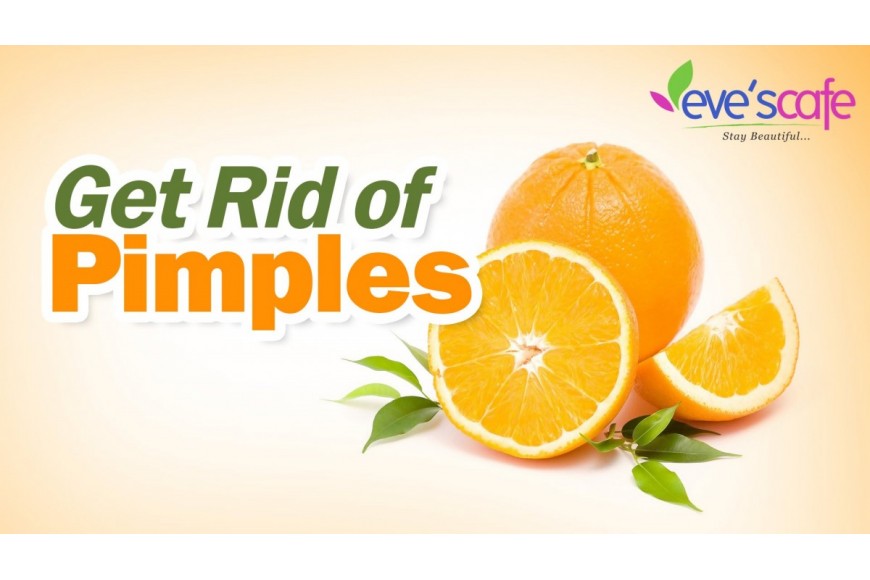 How To Get Rid Of Acne,Pimples Fast At Home Natural Home Remedies pimples(Acne )treatment