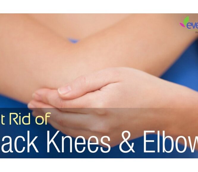 Lighten Dark Knees & Elbows using Baking soda