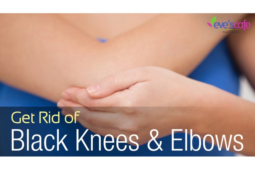 Lighten Dark Knees & Elbows using Baking soda