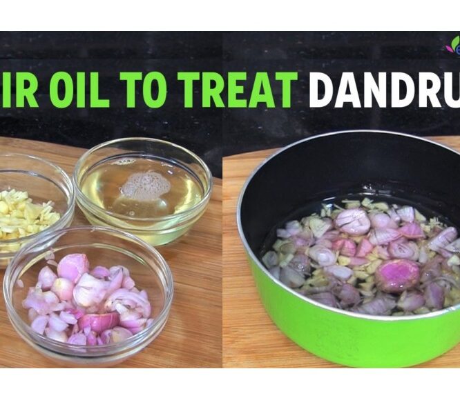 Anti-Dandruff Hair Oil Preparation – Dandruff Cure | Natural Hair Care