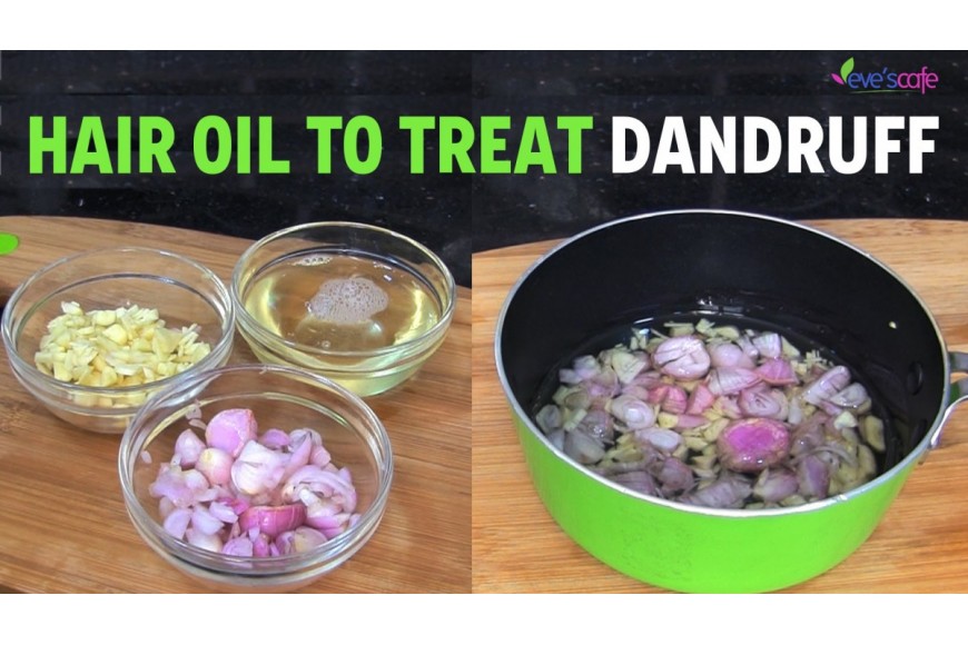 Anti-Dandruff Hair Oil Preparation – Dandruff Cure | Natural Hair Care