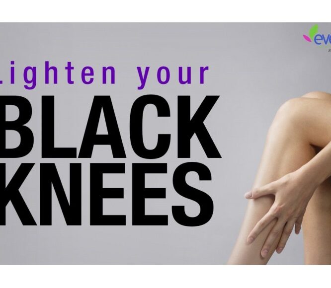 Natural Home Remedy to Lighten Dark Knees and Elbows