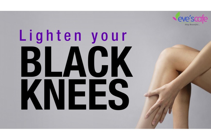 Natural Home Remedy to Lighten Dark Knees and Elbows