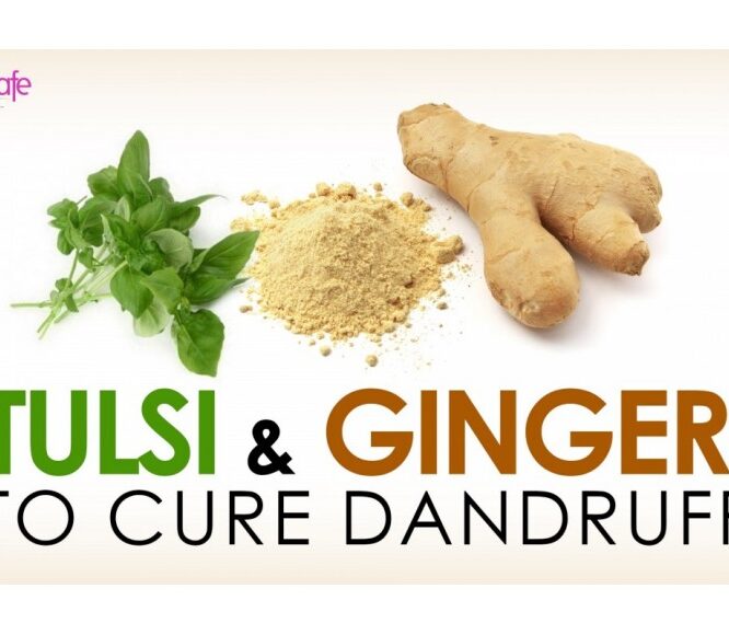 Evescafe | Natural Remedies for Dandruff | Treat Itchy Scalp Naturally