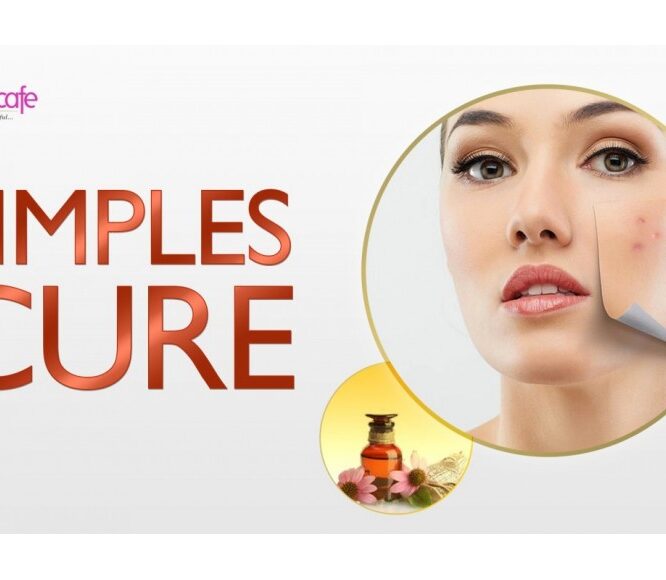Home Remedies for Acne ? DIY Clear Skin!