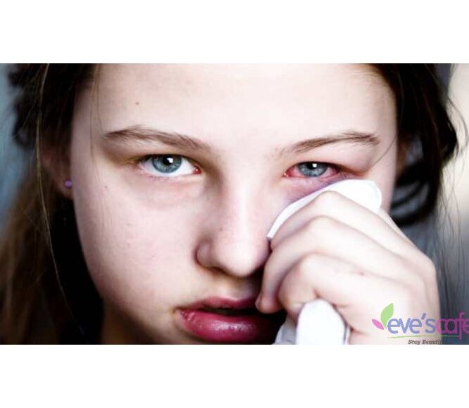 Causes and Symptoms of Eye Infections
