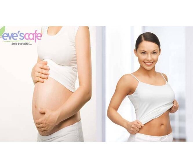 Tips for Tightening the Skin after Pregnancy