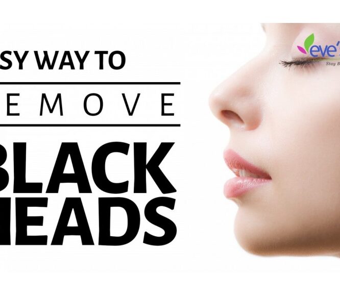 Evescafe | Remove Blackheads and Whiteheads at Home